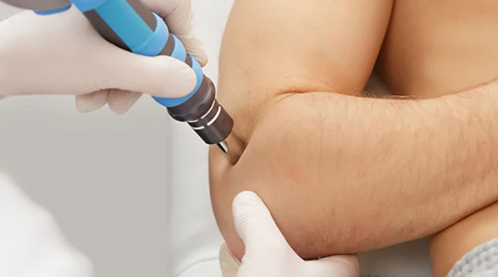 شاک ویو تراپی