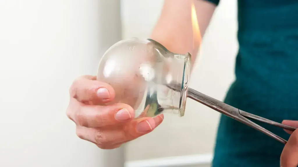 بادکش درمانی