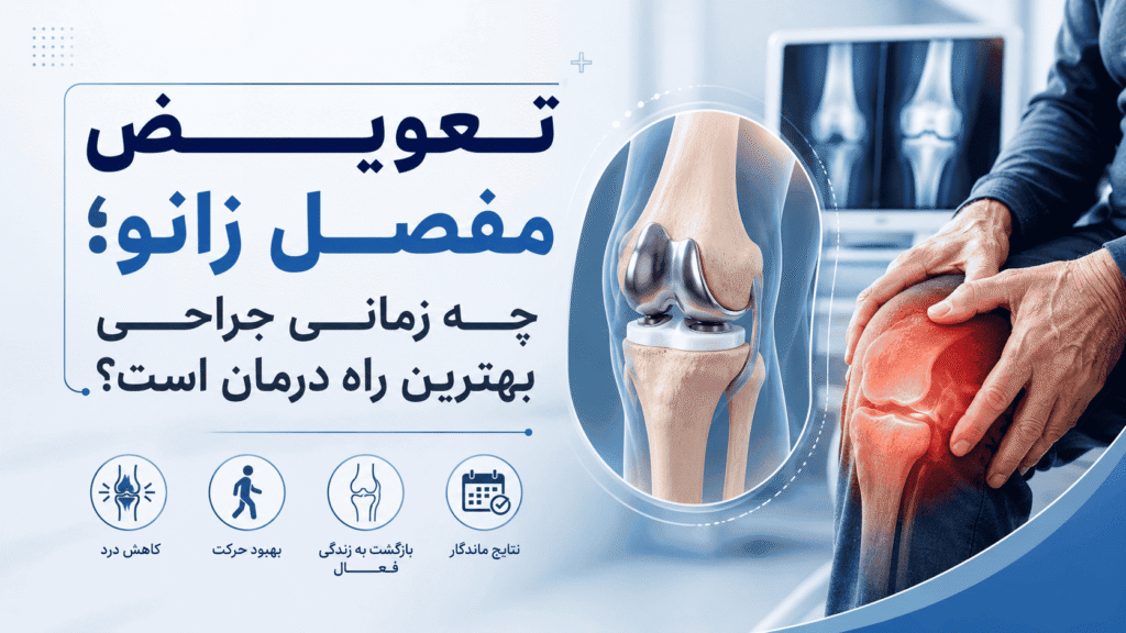 تعویض مفصل زانو