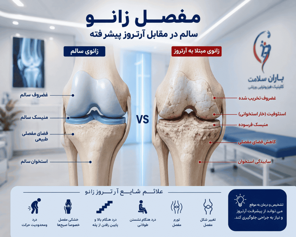 تعویض مفصل زانو
